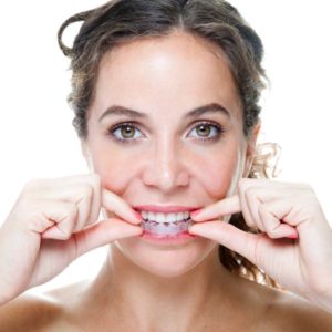 woman using clear braces