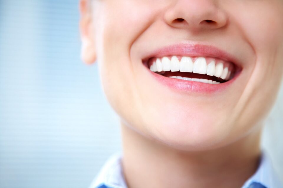 Smile enhancement at Smiles of Anderson in Anderson, IN, using Botox cosmetic services.
