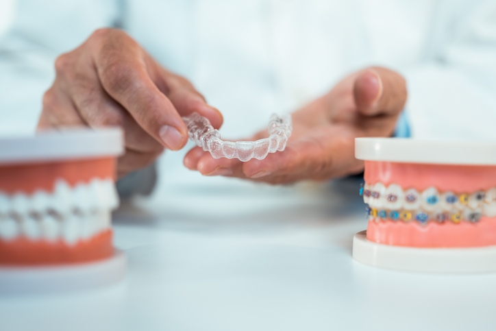 Side-by-side comparison of Invisalign aligners and metal braces at Smiles of Anderson.